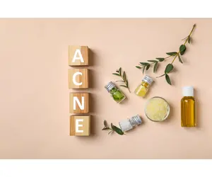 Oli essenziali per acne: rosmarino, lavanda, calendula, rosa mosqueta, olio di tea tree